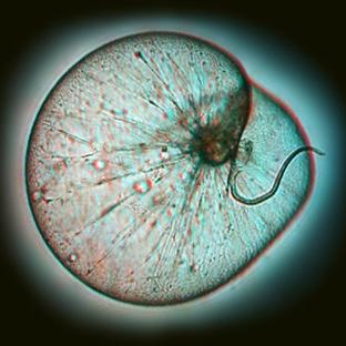 Noctiluca